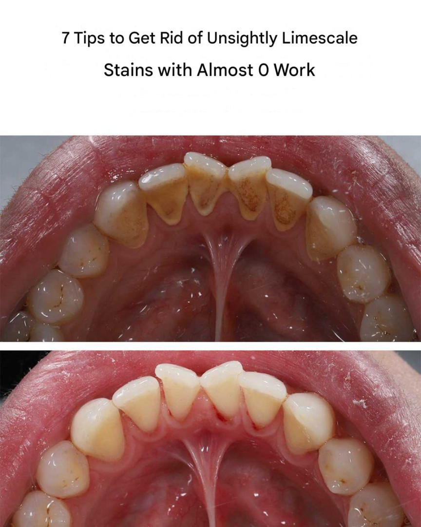 536283878 122221895534114381 1098855986435020868 N